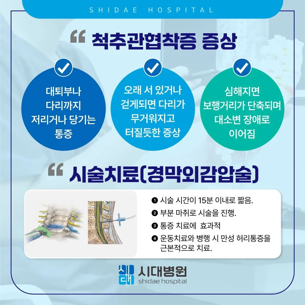 시대병원 척추관협착증 증상과 시술치료 안내